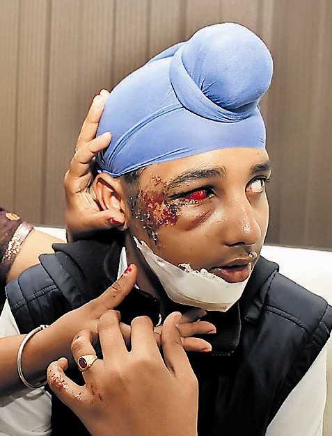 ... a student of MGN Public School on Thursday was injured when his scooter skidded on a potholed road at Ravinder Nagar. The victim, Rajvir Singh, ... - 2015_3%24largeimg21_Mar_2015_005355583