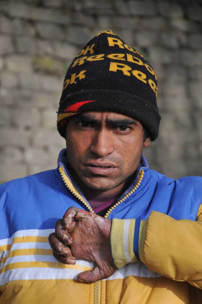 Army comes to rescue of injured Nepalese porter