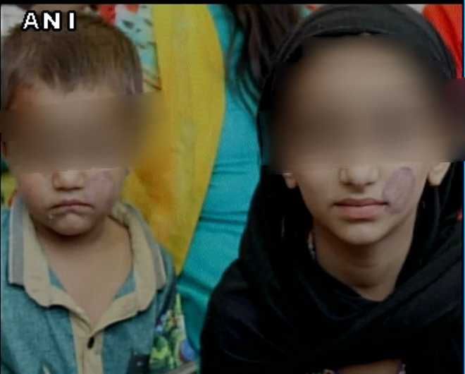 Bhopal jail staff stamp seal on minors' faces who came to see father