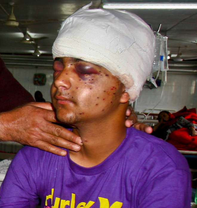 Boy hit by pellets regains sight at Amritsar hospital