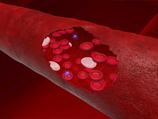 New artificial vessels that prevent blood clots