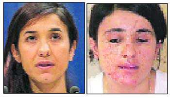 2 Yazidi women win EU human rights prize