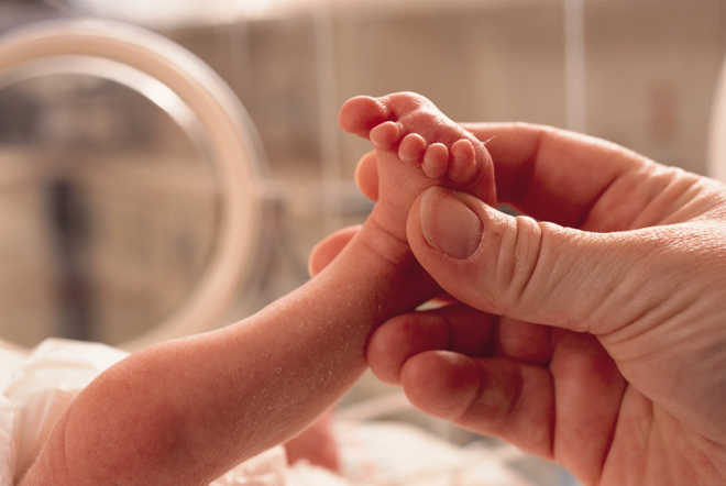 Caesarean births may be ''affecting human evolution''