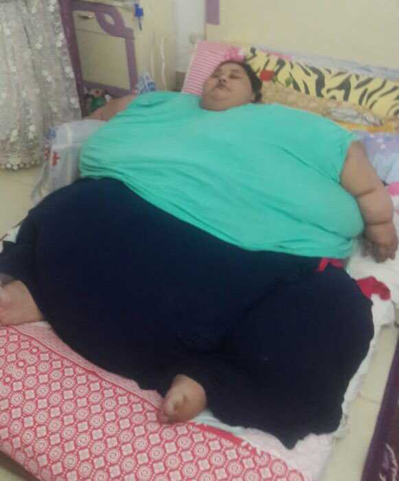 Egyptian woman weighing 500 kg gets medical visa after Swaraj’s intervention