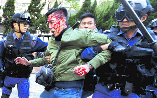 Over 100 hurt as police, protesters clash in HK