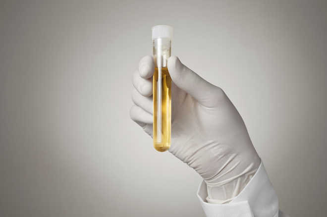 Now, a urine test that ''sniffs'' out prostate cancer