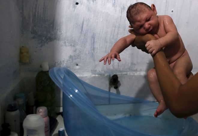 Zika virus linked to serious eye problems in babies
