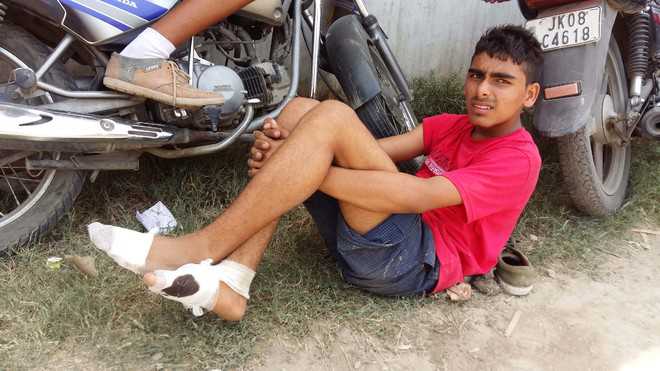 Shocking! Poor athletes in Kathua told to run barefoot in 42°C