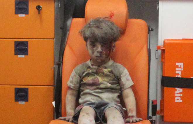 Brother of Omran, Syrian boy in haunting picture, dies