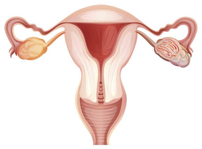 Ovarian removal should be avoided in premenopausal women