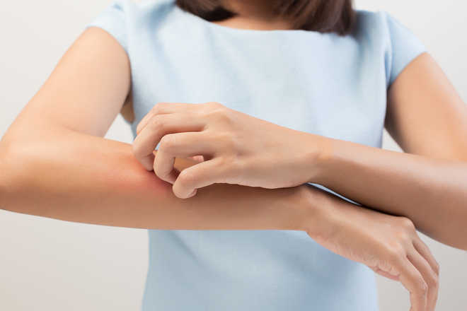 Gene therapy helps treat life-threatening skin disease