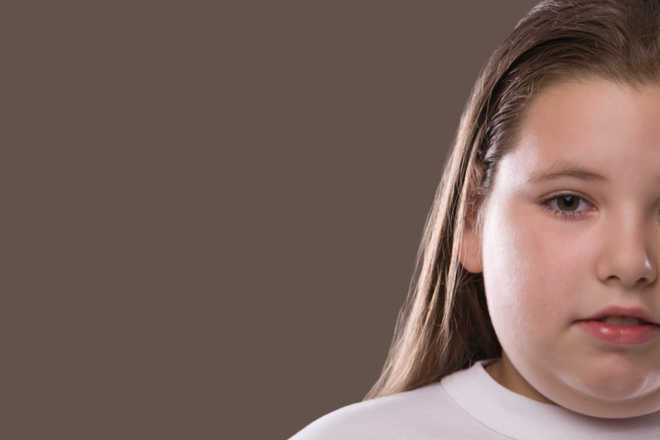 Children inherit obesity from parents