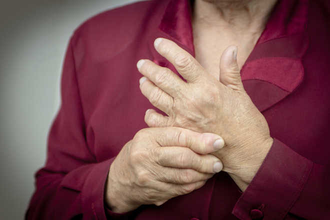 That stiffness can be rheumatoid arthritis
