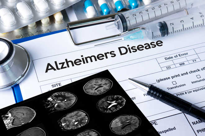 New test may predict onset of Alzheimer''s