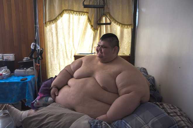 World''s most obese man told to shed 175 kg ahead of surgery