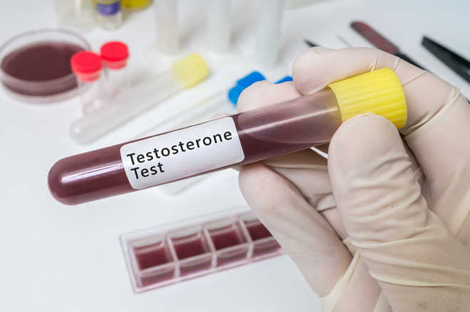 Testosterone increases impulsive behaviour in men: Study