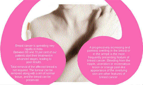 Lack of awareness leading India towards breast cancer epidemic