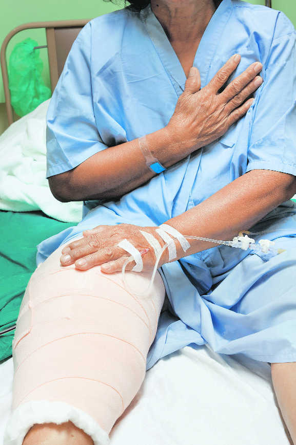 Prices of knee implants cut sharply