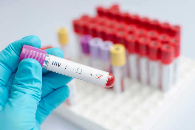 New method to track HIV infection developed