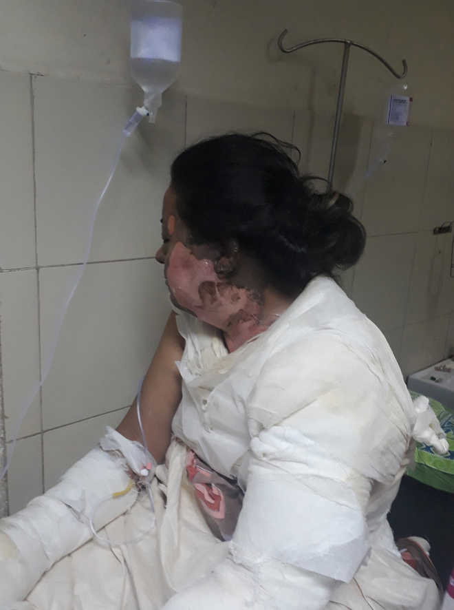 Woman set on fire in Mani Majra
