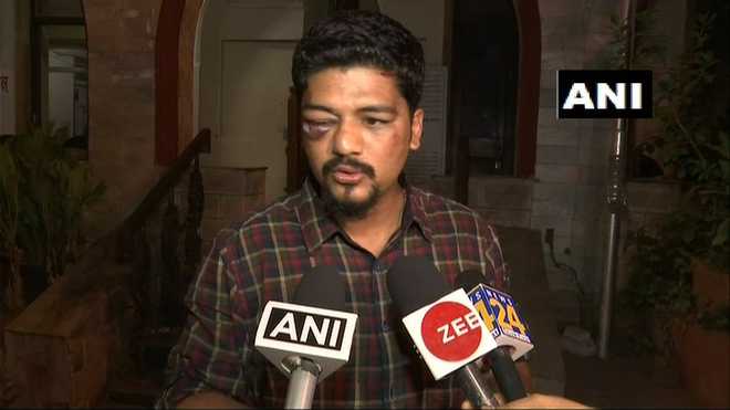TV journalist injured in assault near home in Mumbai