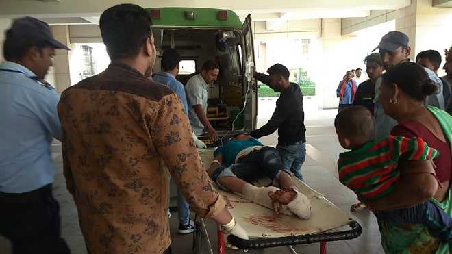 5 Karnal kids seriously injured in blast while making ''desi cracker''