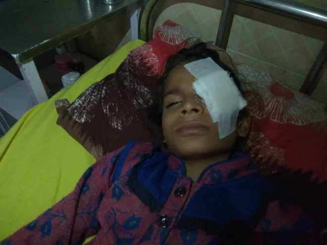 PGI reports 31 cases of firecracker-related eye injuries this Diwali