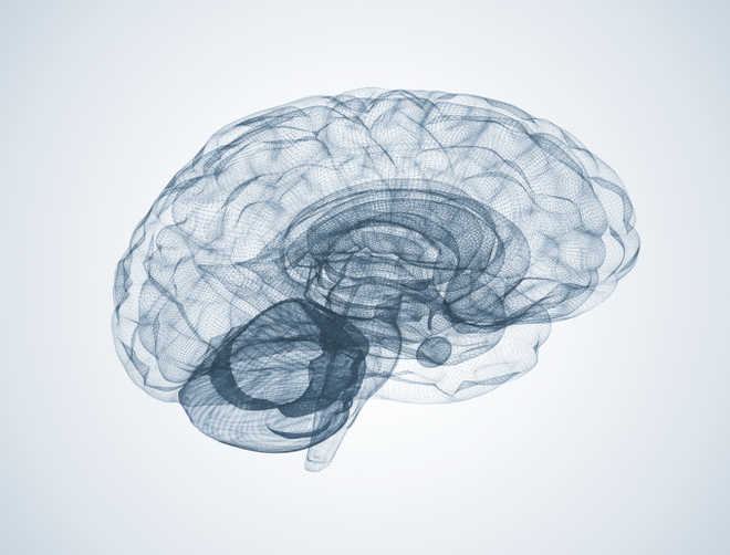 Brain activity pattern may predict schizophrenia