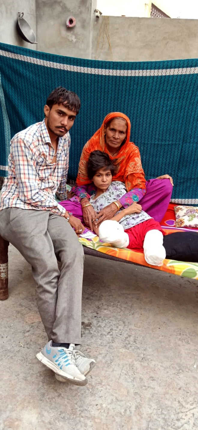 Six months after mishap, girl loses second leg too