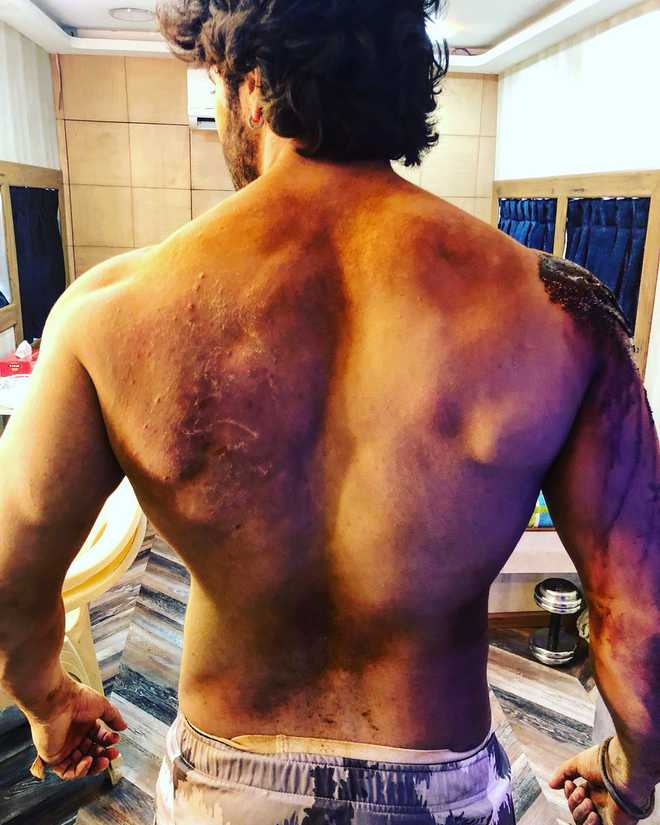 Varun Dhawan gets battle scars on ''Kalank'' set