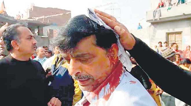 Cong, BJP workers hurl stones