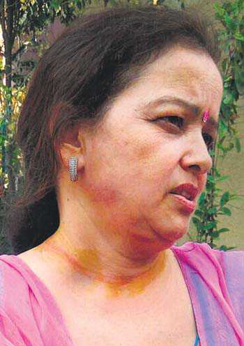 Woman loses chain to snatchers, hurt