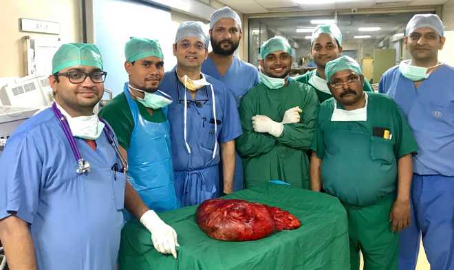 After 10-hr surgery, docs remove 10-kg tumour from farmer''s stomach
