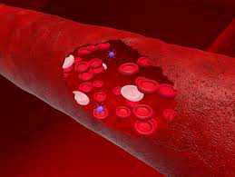 Tiny, smart robots can swim through blood vessels to deliver drugs