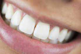 Whitening products may damage teeth