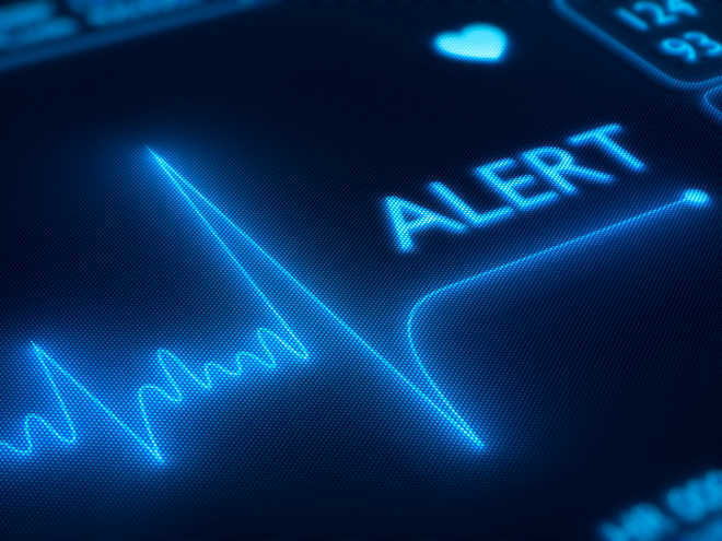 Artificial intelligence overtakes humans in predicting death, heart attack risk