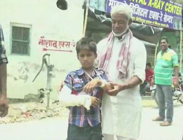 Bihar doc puts cast on wrong hand of boy with fracture
