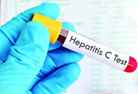Hepatitis B, C cases on the rise; lack of labs delays detection